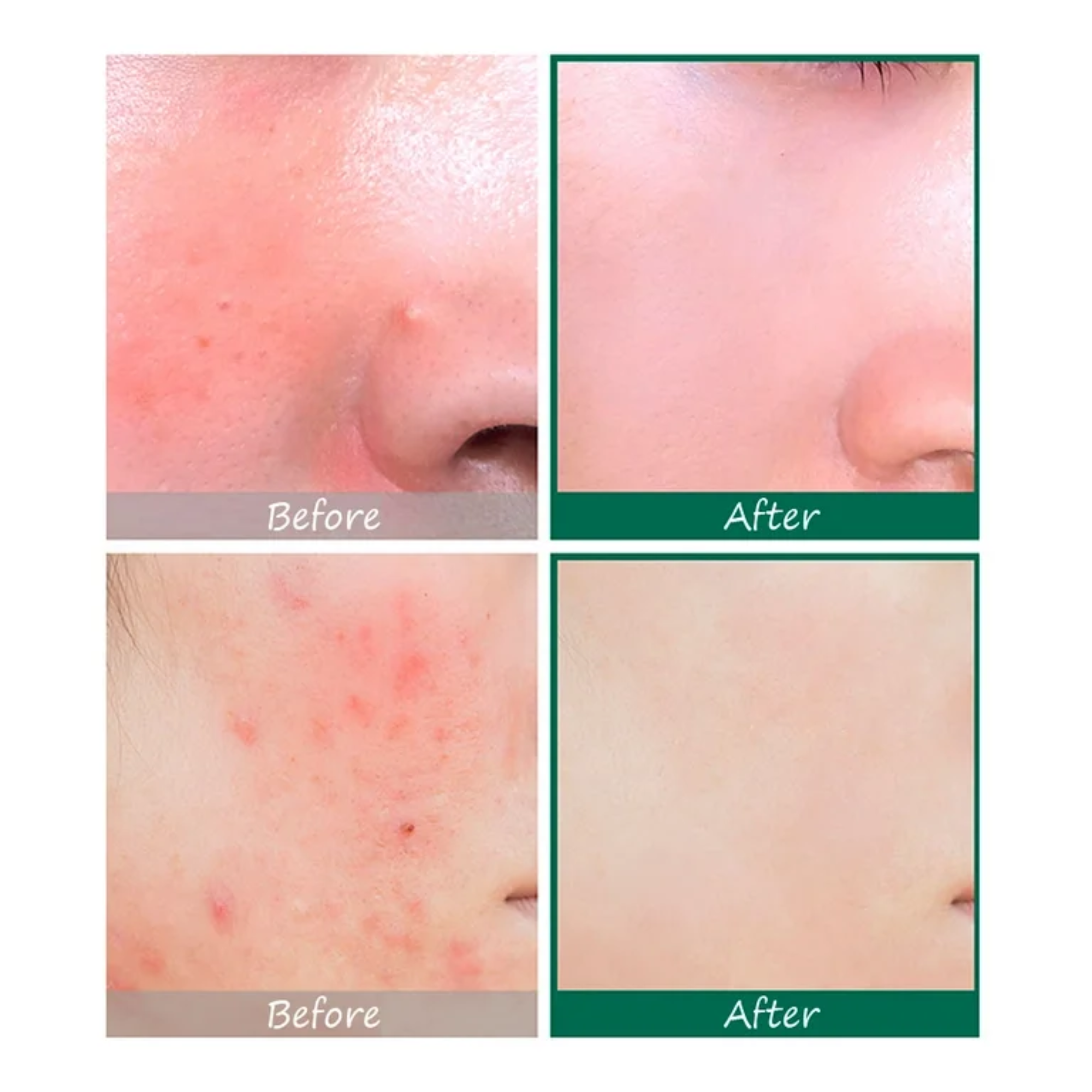 SOME BY MI AHA.BHA.PHA 30 Days Miracle Serum