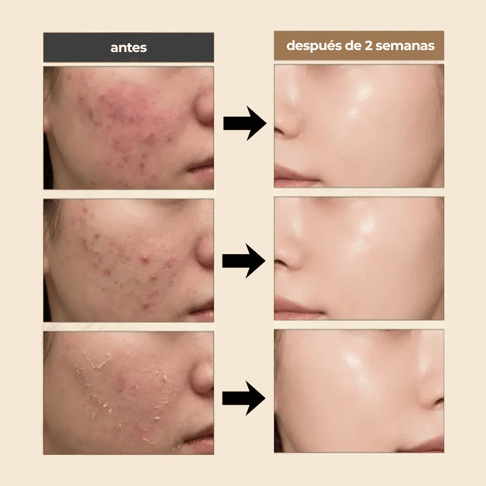 DR. REJU-ALL Advanced PDRN Rejuvenating Cream