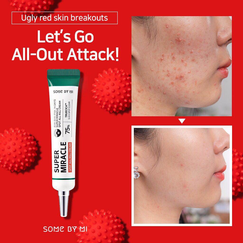 SOME BY MY AHA, BHA, PHA 14 days Super Miracle Spot All Kill Cream