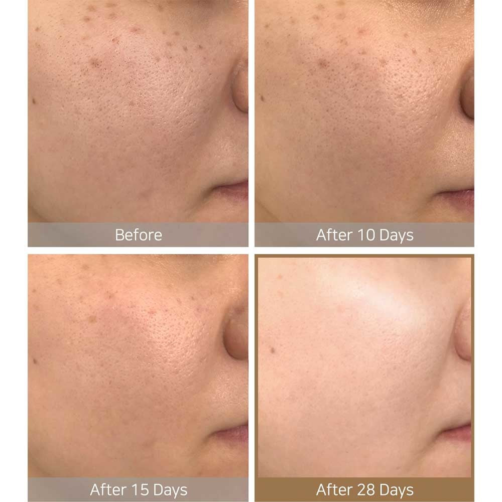 SOME BY MI Galactomyces Pure Vitamin C Glow Toner